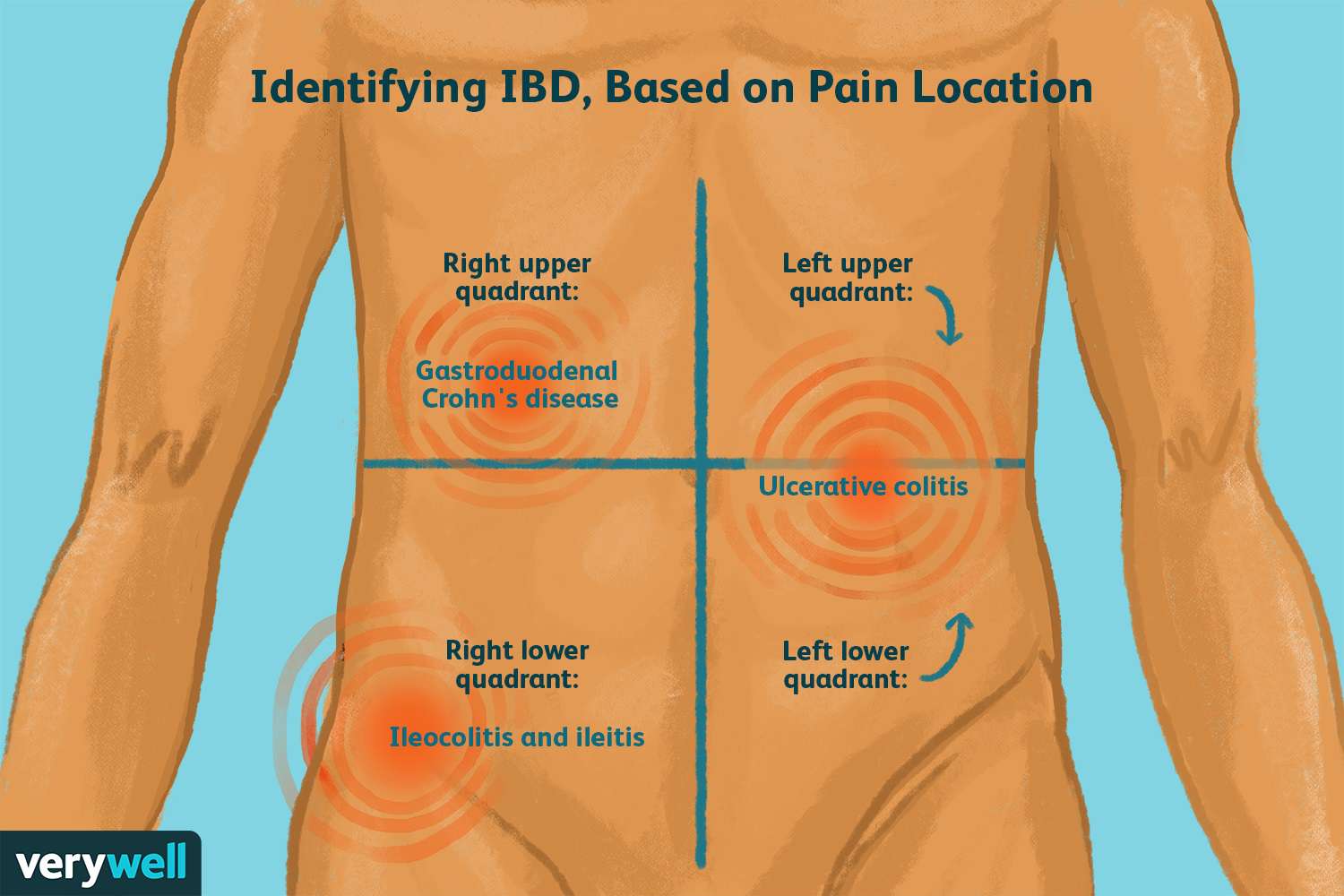 Pain on the Right Side of the Stomach: Causes, Symptoms, and Treatment Guide